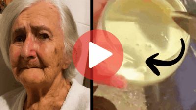 Neurosurgeon presenting the discovery