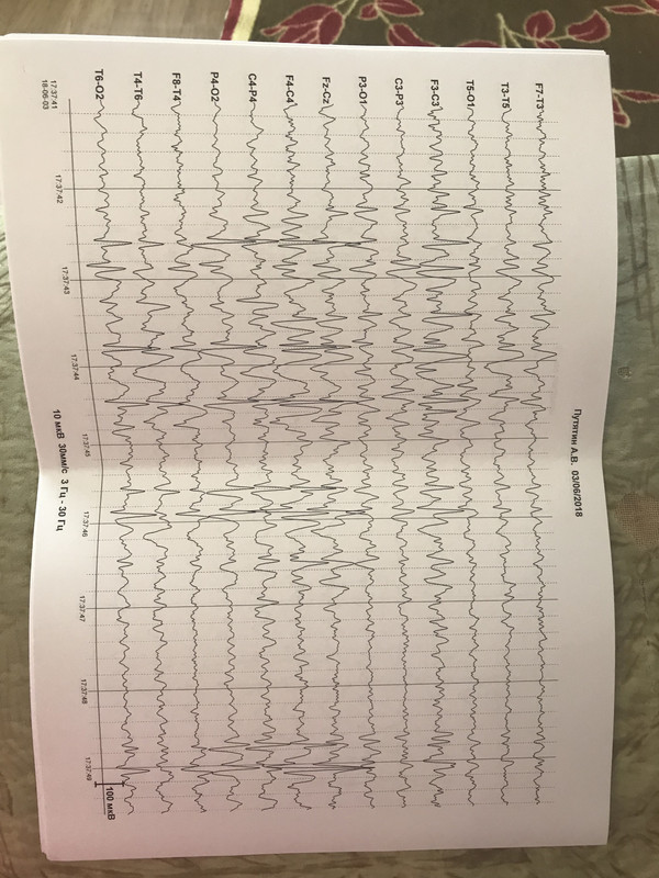 56A732F8-0F57-46BB-A870-5CB32AEA05D2