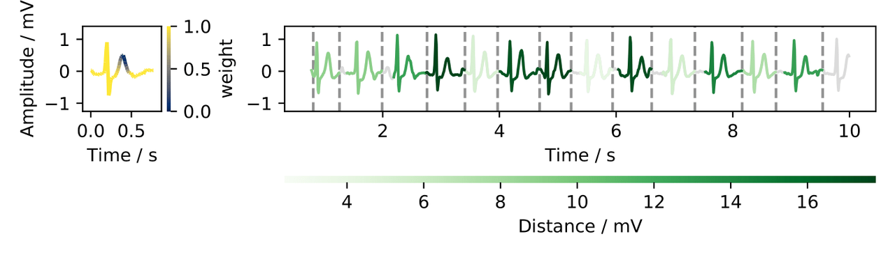 Example ECG segmentation output