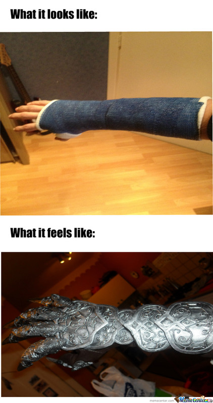 my-broken-hand_o_183419