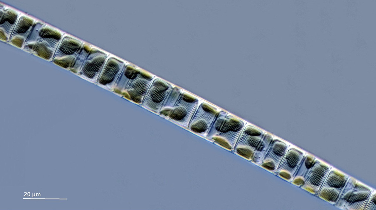 Melosira (Aulacoseira) granulata Gepunktete Faden-Alge DIK 100