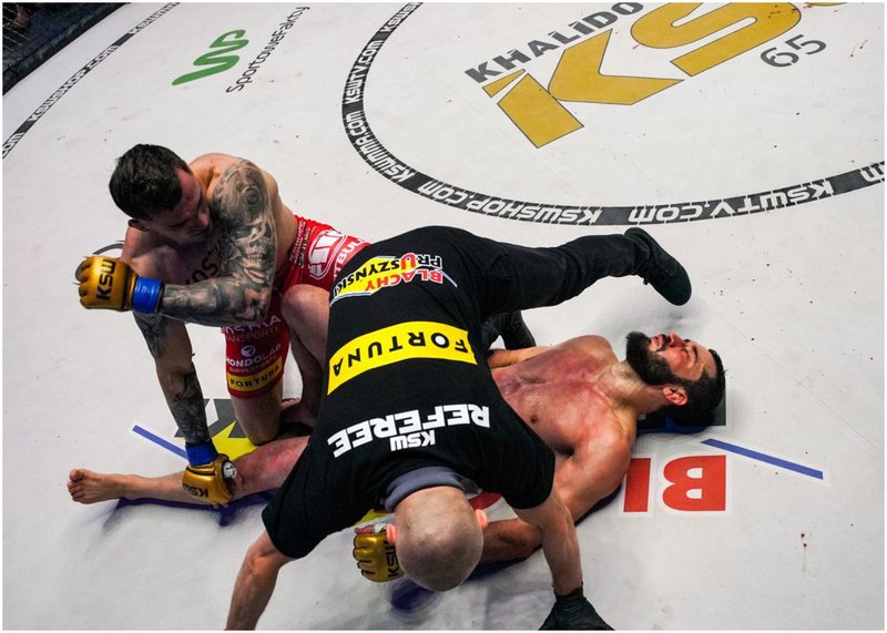 Мамед Халидов оперира потрошеното си лице след KSW 65