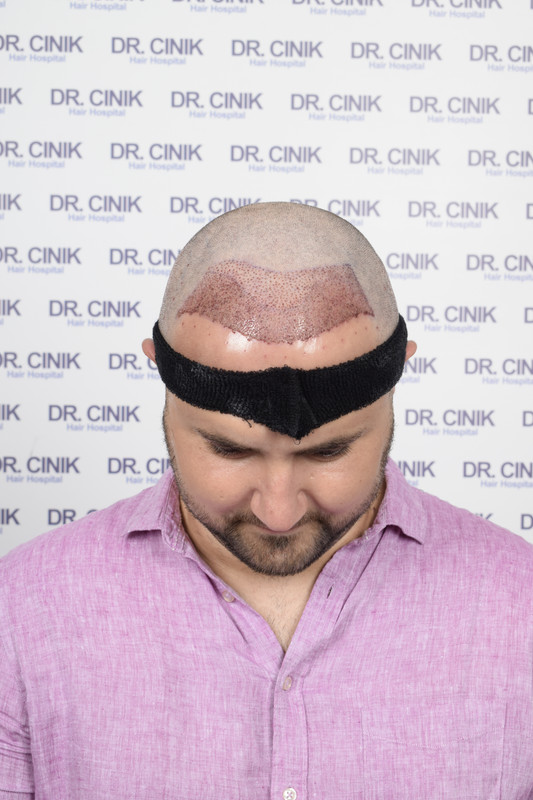 photos postopératoires (9)