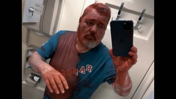 [Image: j4h9fi02pnpo.jpg]