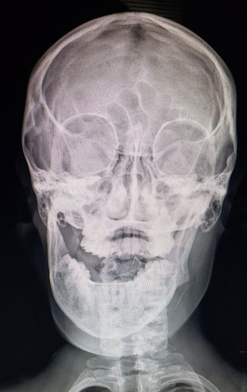Rayos-X-7