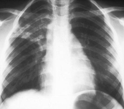 Gastroenterology question 7 image