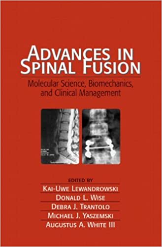 Advances in Spinal Fusion: Molecular Science, BioMechanics, and Clinical Management