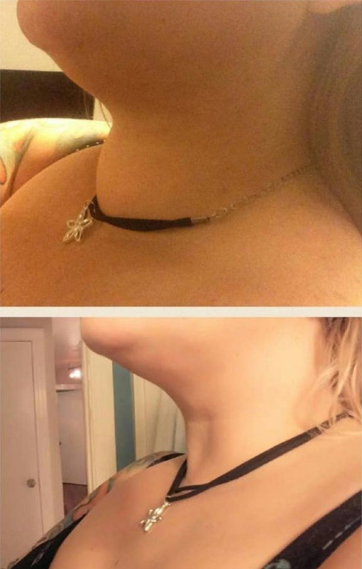 Before-after-16