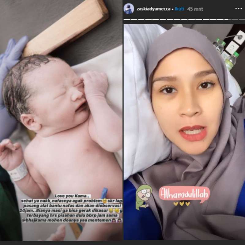 Zaskia Adya Mecca beberkan kondisi terkini anak bungsunya