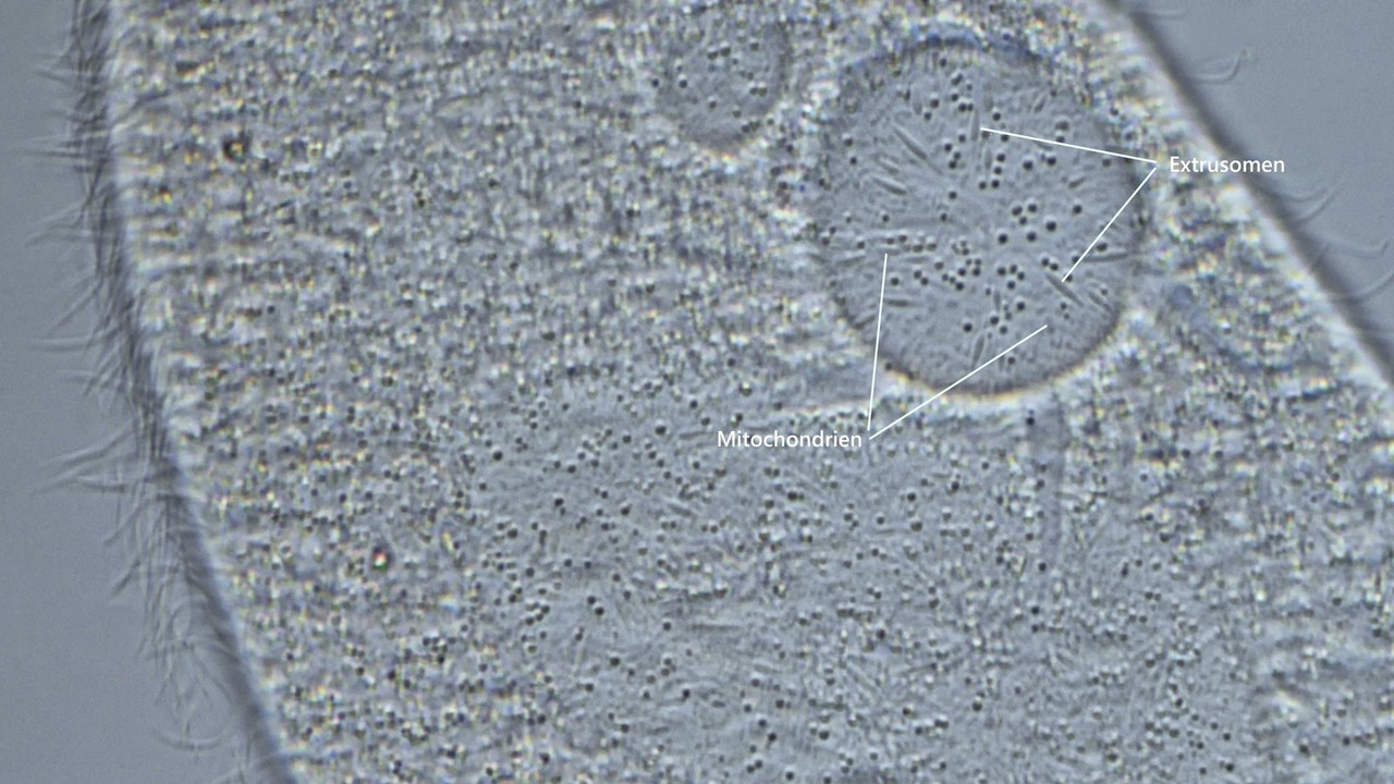 Paramecium 40 caudaum Pantoffeltier Extrusome (ev Mitochondrien) KV und MA DIK 100-Z7