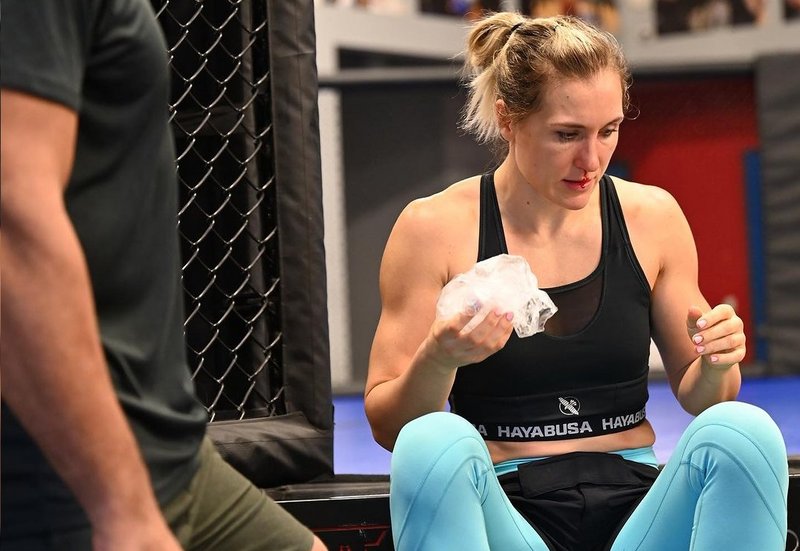 Яна Сантос счупи нос и отпадна от UFC Vegas 84