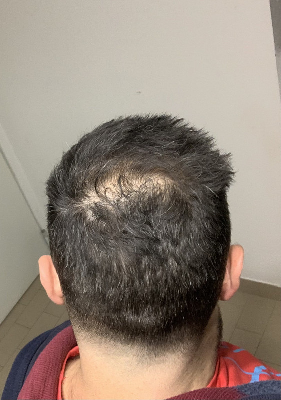 C758F178-06CA-4504-A8EE-DFAC2F72CA30_1_201_a