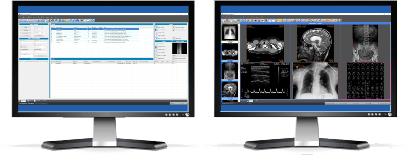 Sante PACS Server PG 4.4.5 – (534 MB) Sante PACS Server PG 4.4.5 – (534 MB)