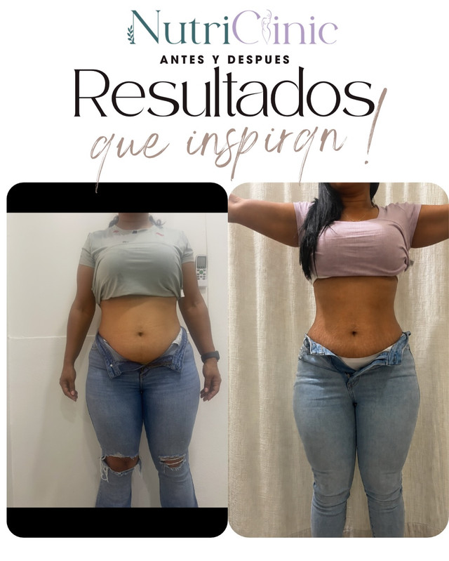 Resultado antes y después 5
