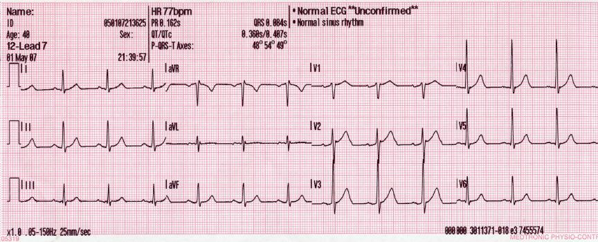Gastroenterology question 3 image