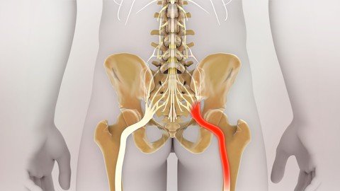 How To Fix Sciatica At Home?