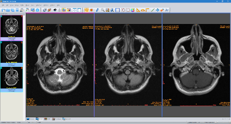 Sante DICOM Viewer Pro 12.1.11