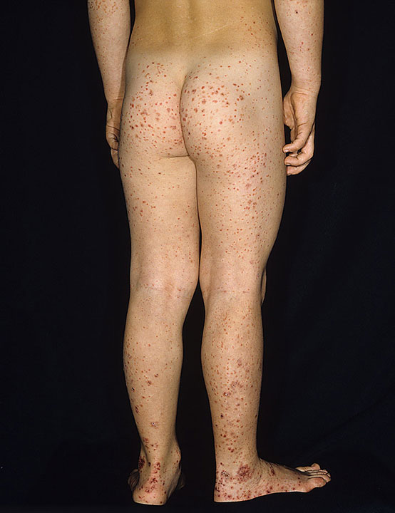 Rheumatology question 8 image