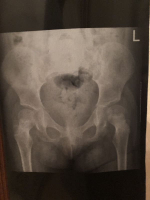 C2EECF0F-9CFE-4476-A234-57215431212F