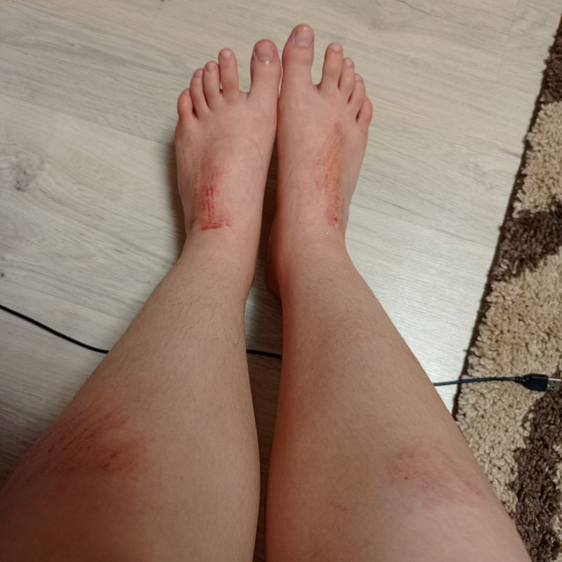https://i.postimg.cc/5Nxt3t7m/photo-2025-07-01-21-56-02.jpg