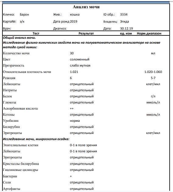 анализ мочи