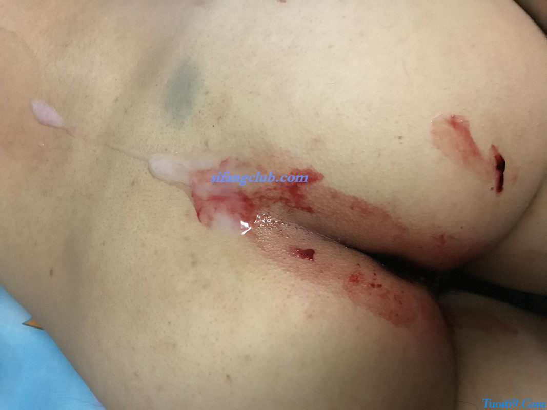 2017-03-21 183702 (Copy)