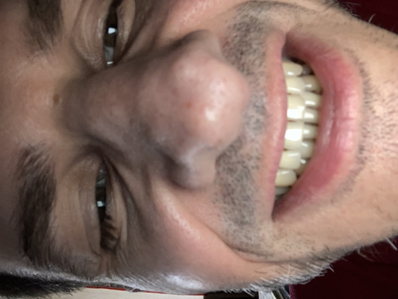 AWROE 5