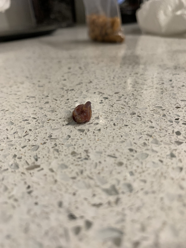 82F6133C-D455-4B93-A919-D47EC119CF9B