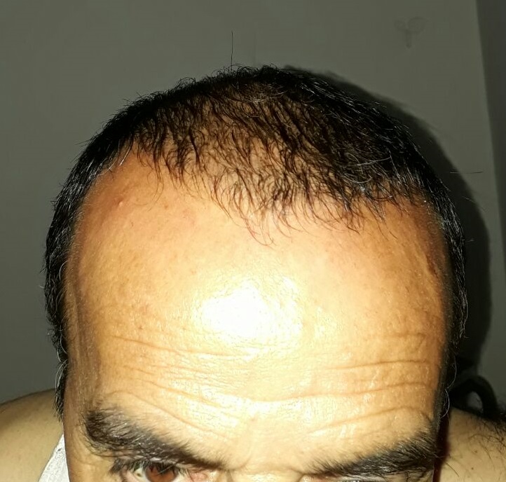 WhatsApp Image 2017-07-17 at 21.38.20 (1)