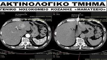κοζάνη, ειδήσεις, νέα, Πτολεμαΐδα