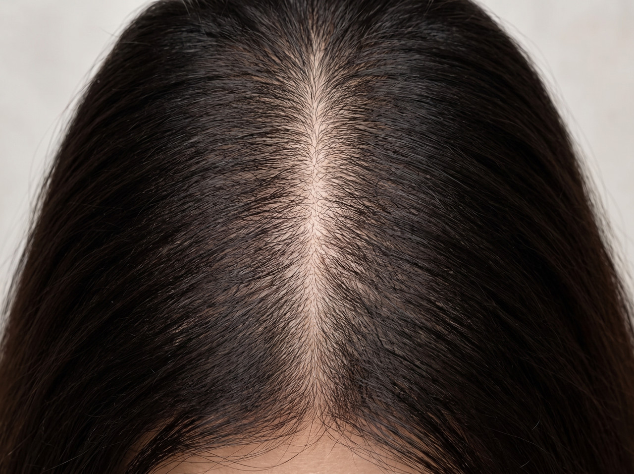 Hair Before Treatment