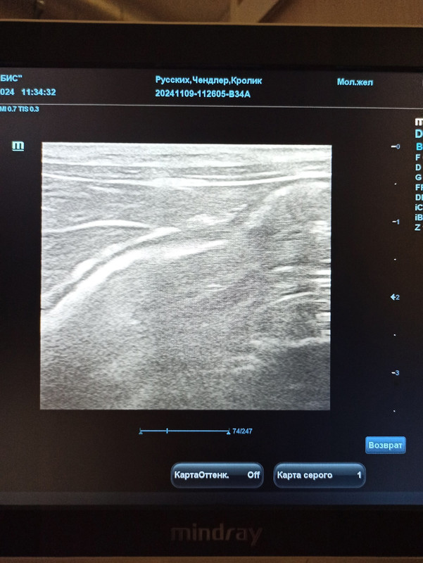 узи кишечник