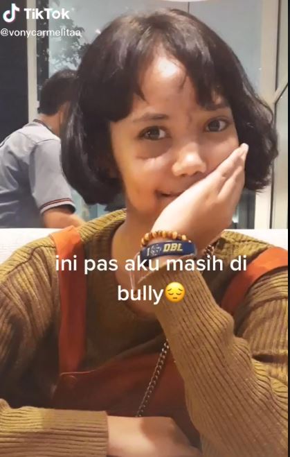 Kondisi Ivonny setelah lumayan pulih