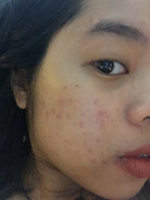 A8342F75-E1A0-417A-B550-68229CC3068F