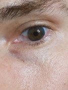 eye1