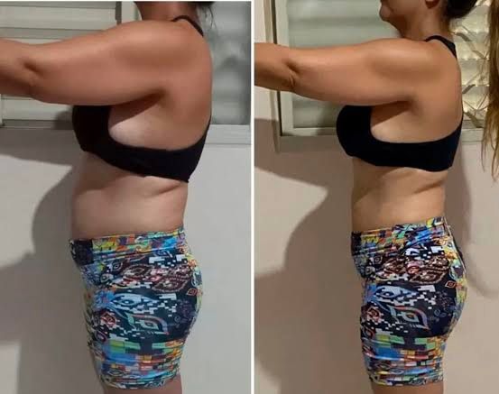 Resultado antes e depois