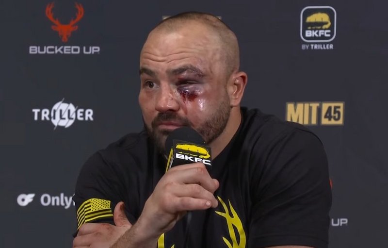 Еди Алварес е със счупена ортибална кост след BKFC 56