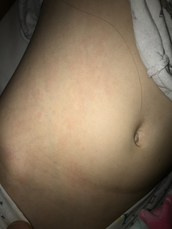 644BDB25-10C1-45E2-B6A5-A77D97826901