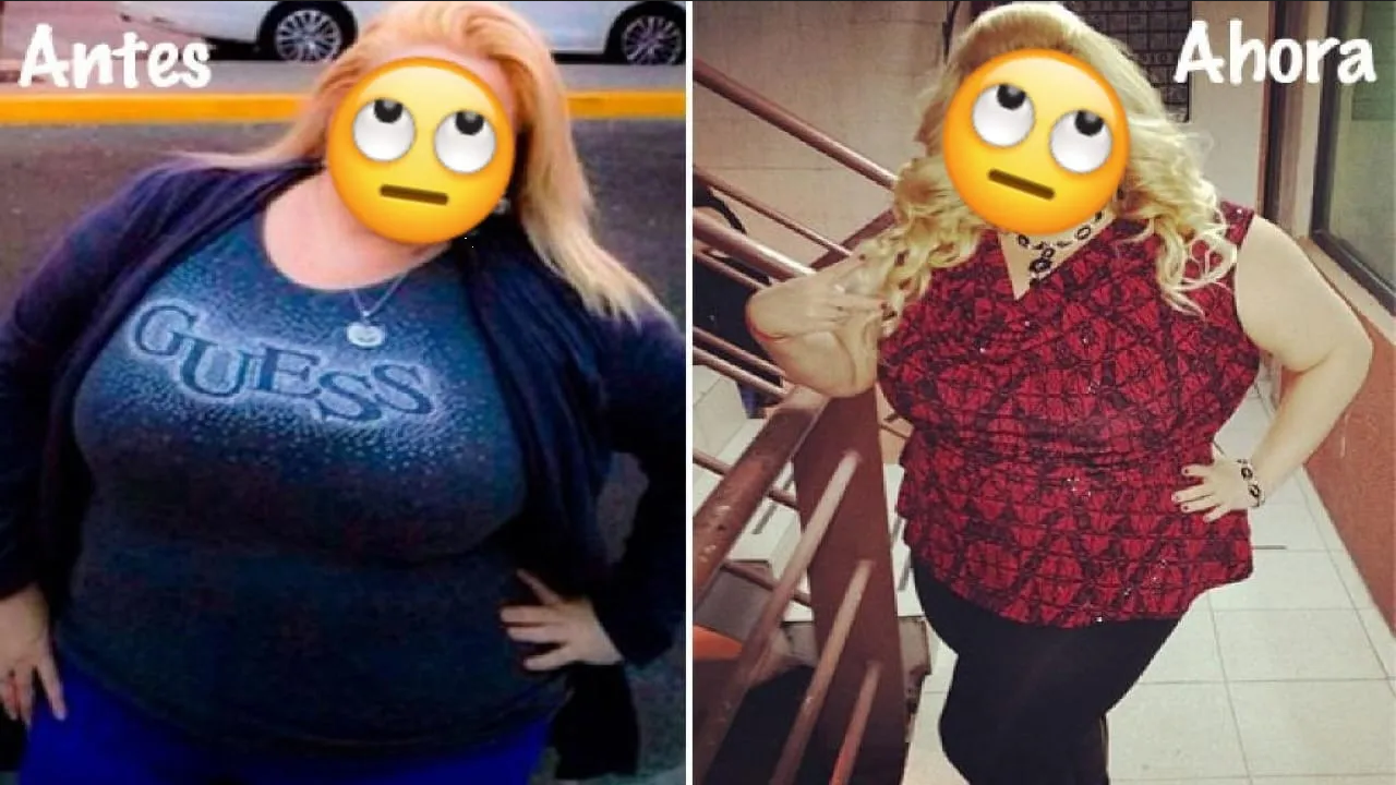 Tras someterse a cirugía bariátrica, famosa vuelve a subir 70 kilos y así luce ahora