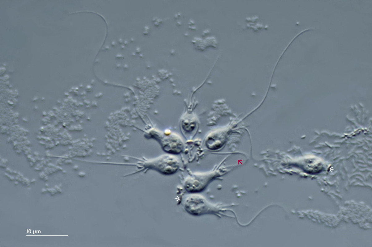 Salpingoeca 16 (ev) amphoridium Gehäuse-Flag (Gehäuseboden rund auf Platte) DIK 100-Z7