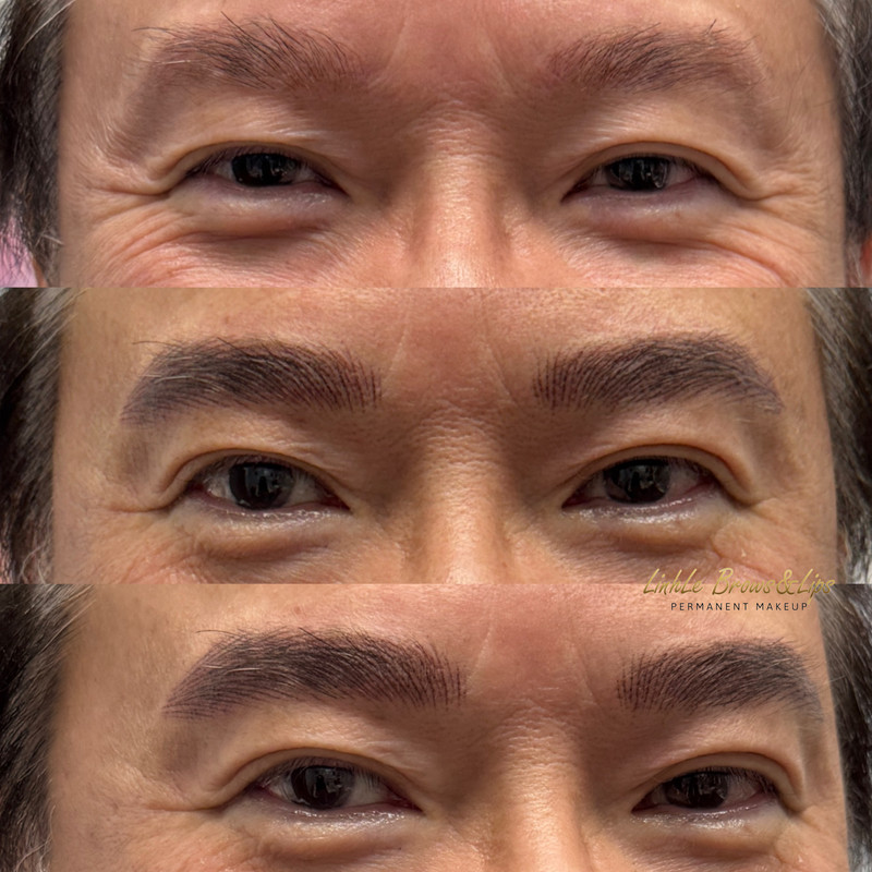 Eyebrow Enhancement Example New 2