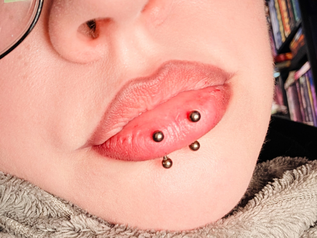 My double vertical labret piercings