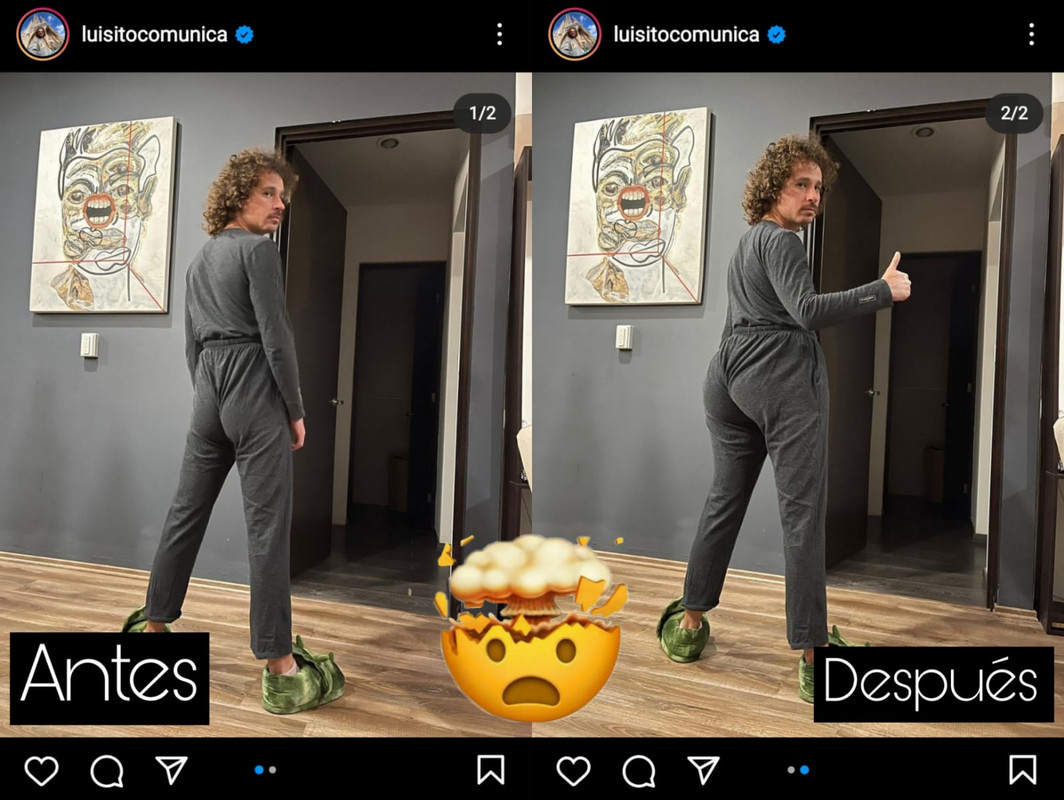 ¿Luisito Comunica se operó la retaguardia? Nueva imagen enloquece a los fans