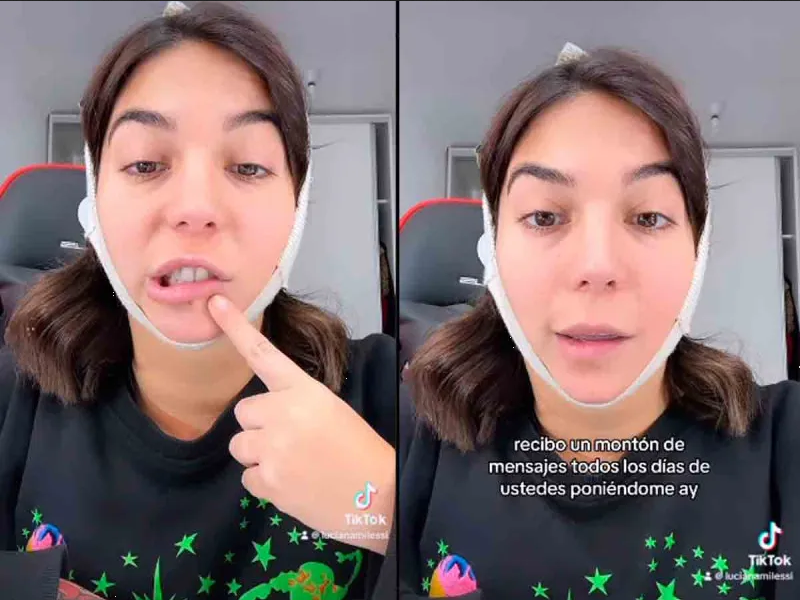 Influencer sufre parálisis facial tras cirugía estética