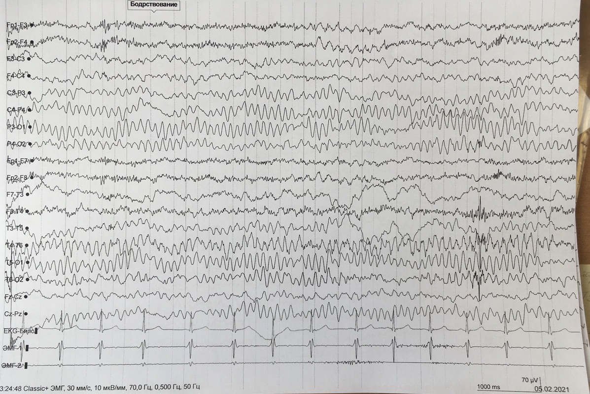 73F75B69-1CCC-4686-860A-FA6DE1A48C8F