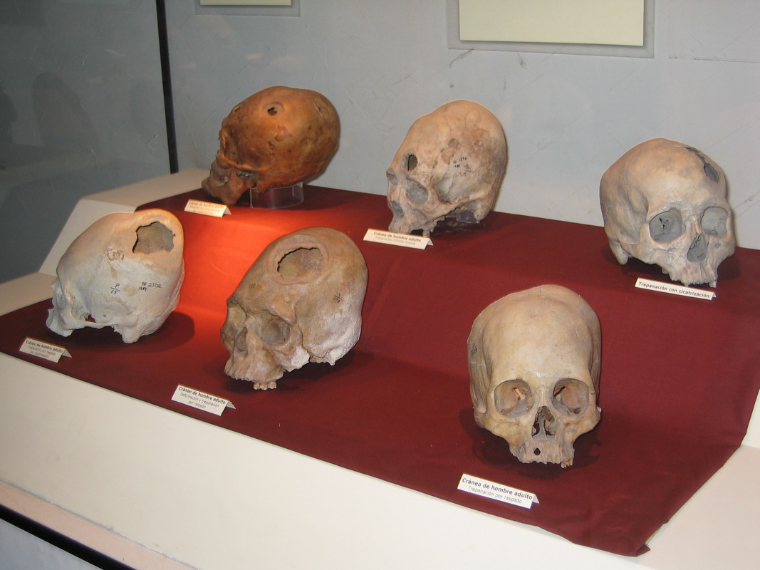 014 20050305 1137 Craneos trepanados
