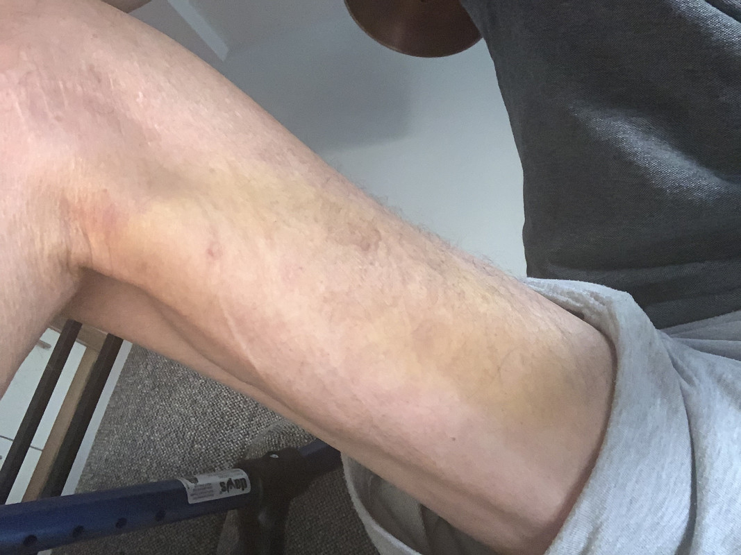 63F334A5-874E-43DD-BCAB-293DE68B4D12