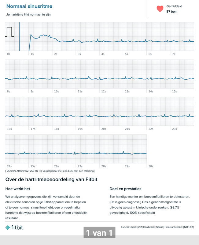 ECG - Low voltage readings - Fitbit Community