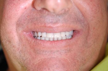 Caso clinico 3, risultato finale