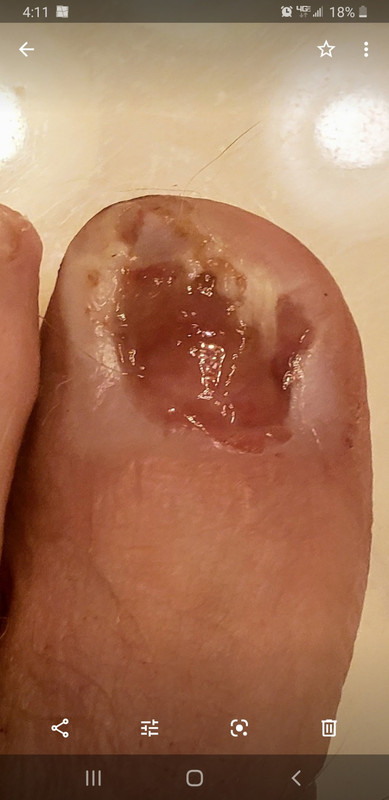 Screenshot_20230414-183505_Gallery